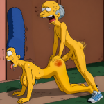 burns.png