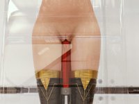 Kinetichloro 22a.jpg